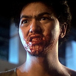 mental patient acting like zombie